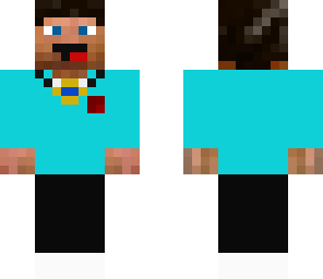 alex's new skin