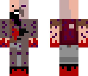 trastorned notch