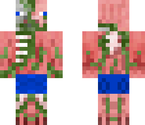 my skin
