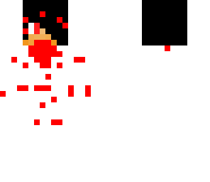 your dead