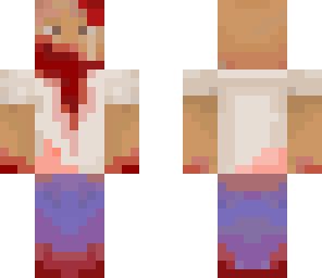 skilter zombie