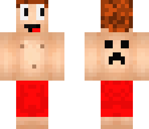 epic skin