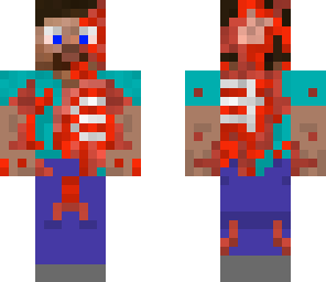 zombiesteve