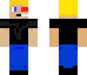 the real allen skin