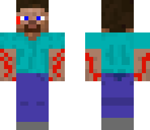 steve that is hurt badly