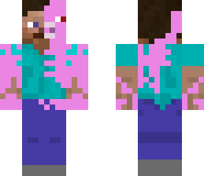 steve with pig infection