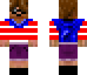 it is my skin