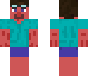 sunburned steve