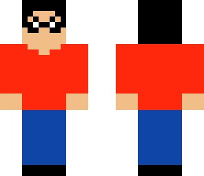 kevin's skin