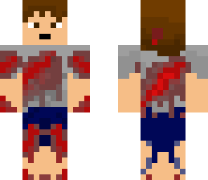 my skin 4 - blood