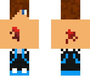 bleeding boy