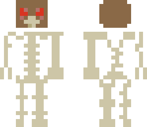 skely