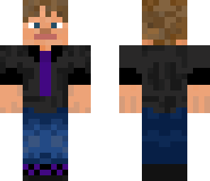 gabe's skin