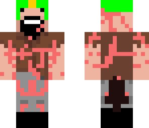 this guy has the chicken pox
