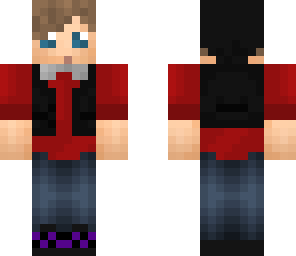 gabe's skin