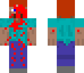 injured steve