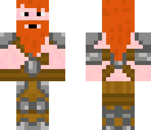 dwarf ginger hair