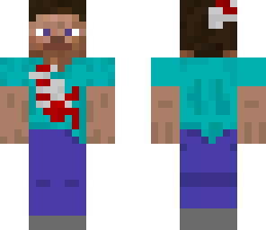 injured steve