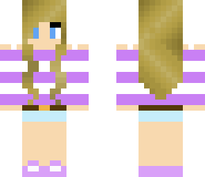 carl's skin