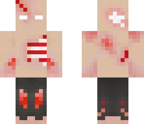 diseased zombie