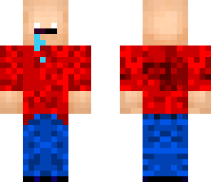 my skin