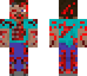 injured steve