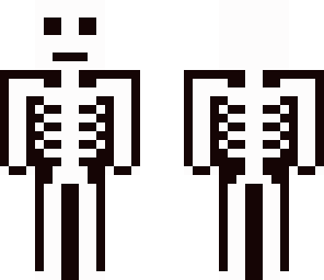 x-ray thingy fixed completely