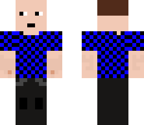 male pattern baldness