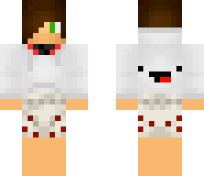 nicholas's skin