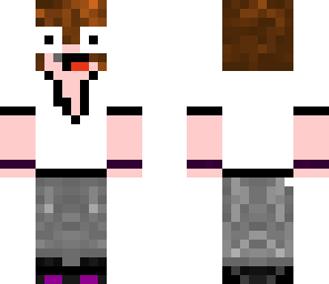 suprised deadlox