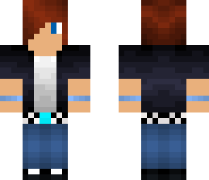 matt's skin