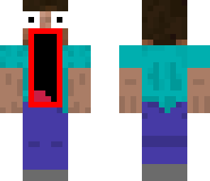 suprise sucker