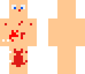 skin base covered in blood
