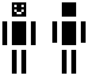 x-ray