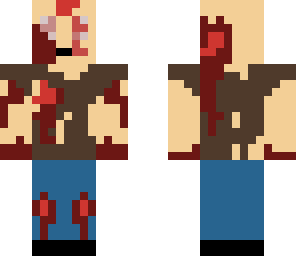 the destroyed zombie