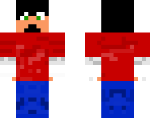dude with broken arms