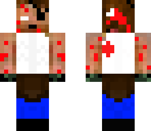 armless dead man