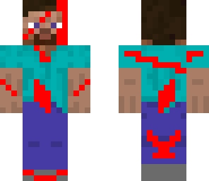 injured steve