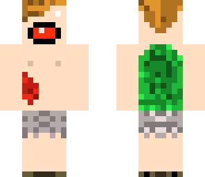 shark attack survivor