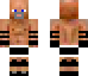 goldberg