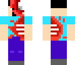 injured steve