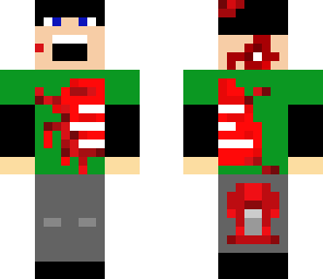 very injured guy