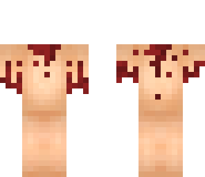 mutilated dead body