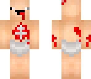 undead noob