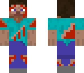 injured steve