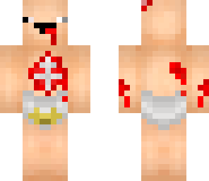 little dead noob