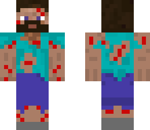 steve one year later injured