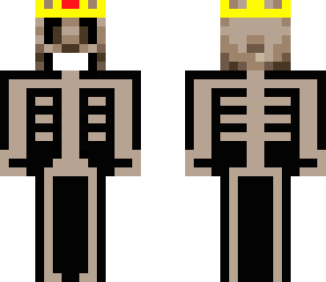 undead king