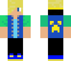 alek's skin