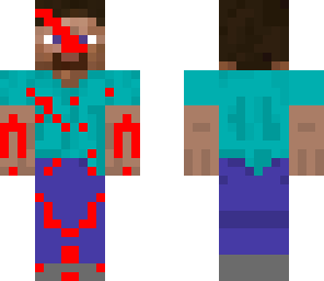 injured steve